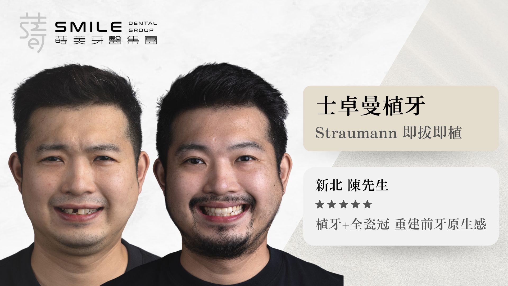 蒔美straumann即拔即植案例