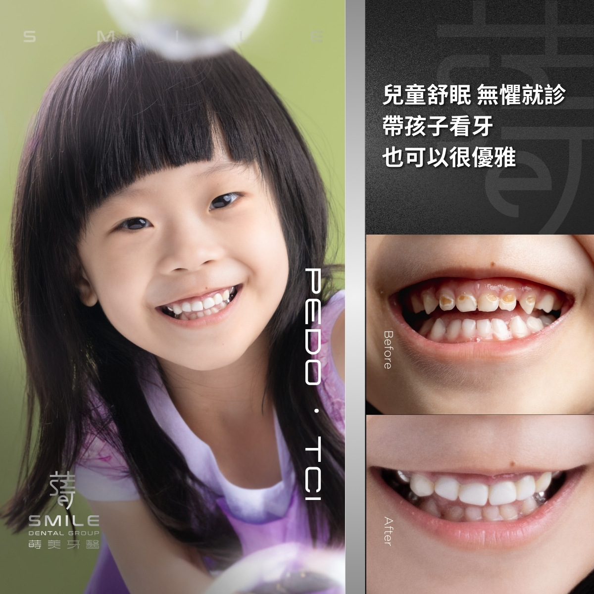 兒童舒眠案例-台北兒童牙科植推薦-蒔美牙醫-1