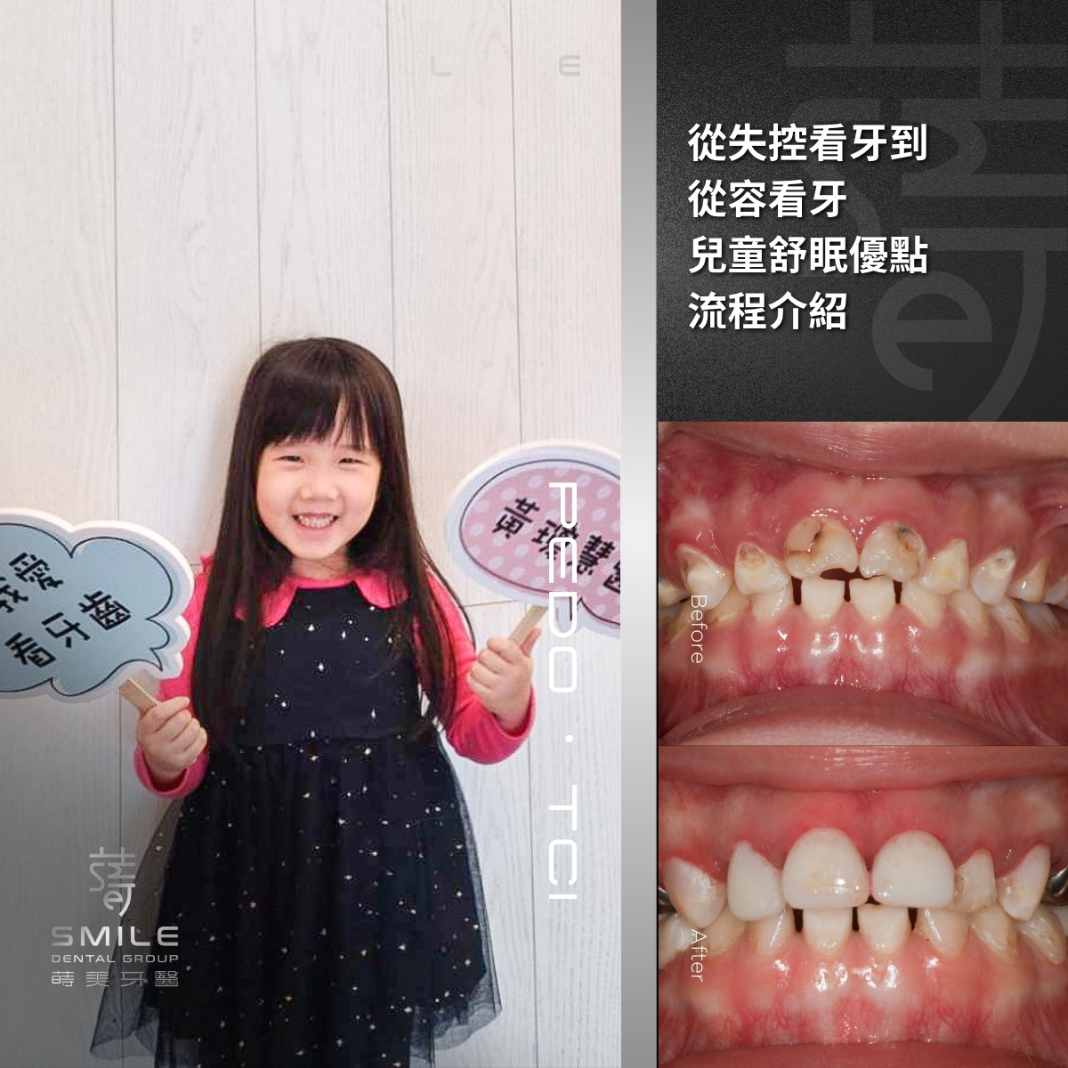 兒童舒眠案例-台北兒童牙科植推薦-蒔美牙醫-2