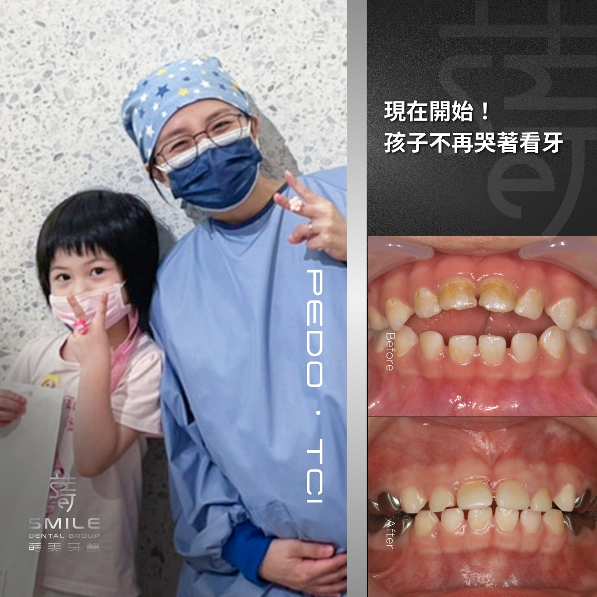兒童舒眠案例-台北兒童牙科植推薦-蒔美牙醫-3