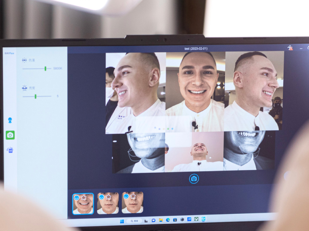 隱適美頁面優化-設備-數位笑容模擬
